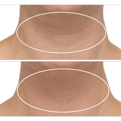 STRIVECTIN - Ensemble de 2 Crèmes Raffermissantes pour le Cou Plus-pack-advanced-tightening-neck-cream-costco-120447-4