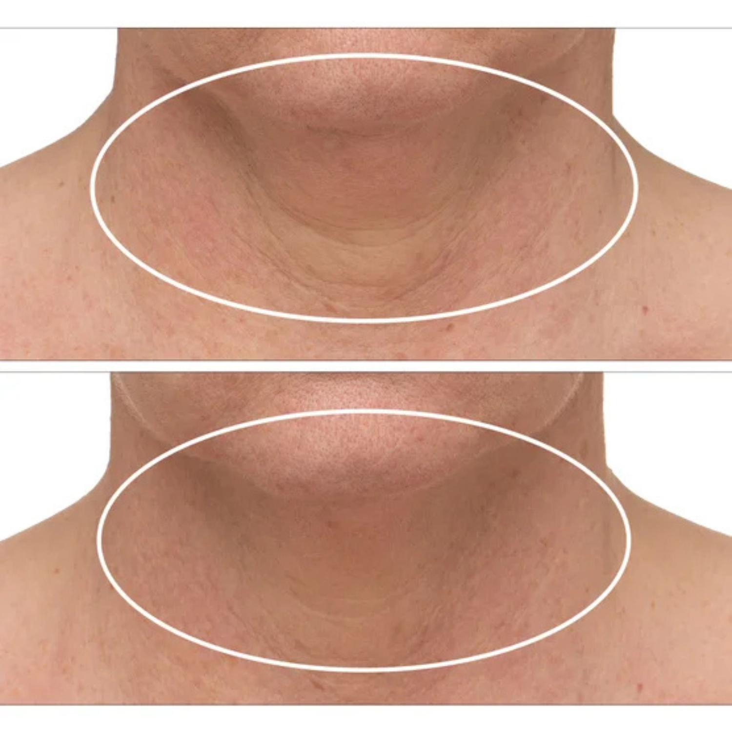 STRIVECTIN - Ensemble de 2 Crèmes Raffermissantes pour le Cou Plus-pack-advanced-tightening-neck-cream-costco-120447-5
